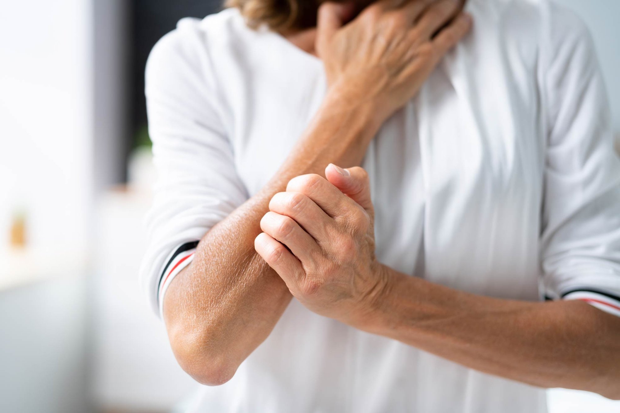 PFDM Report - Psoriasis